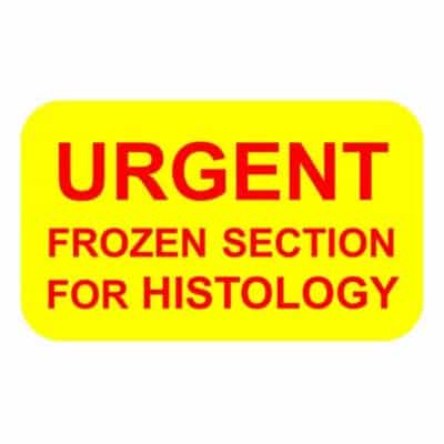 URGENT FROZEN SECTION FOR HISTOLOGY Label